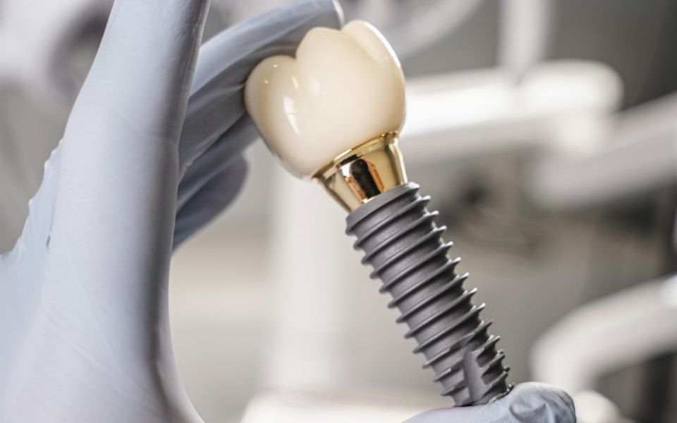 Kronlu titanyum diş implantı